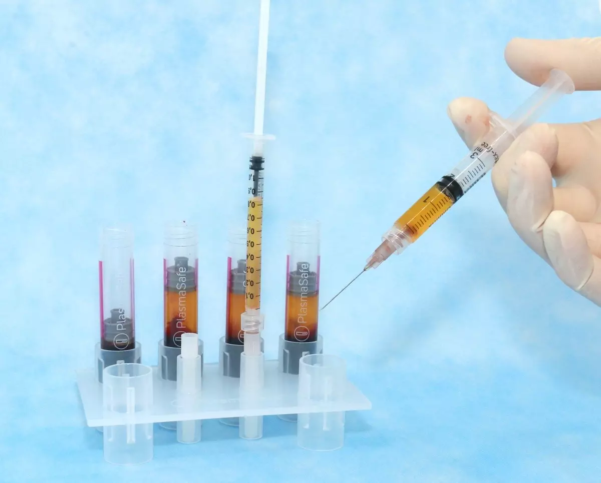PRP-Aufbereitung mit PlasmaSafe-System